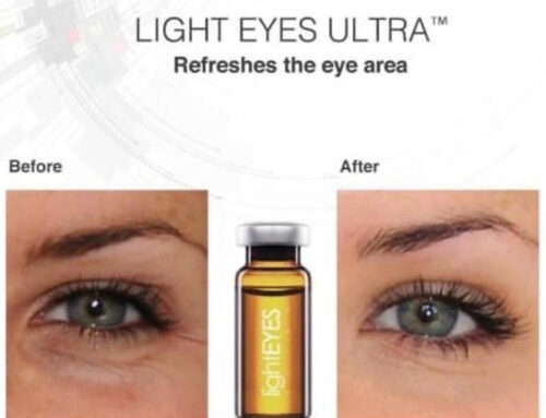 Light Eyes Ultra: The Italian’s Secret Weapon For Under Eye And Eyelid Treatments