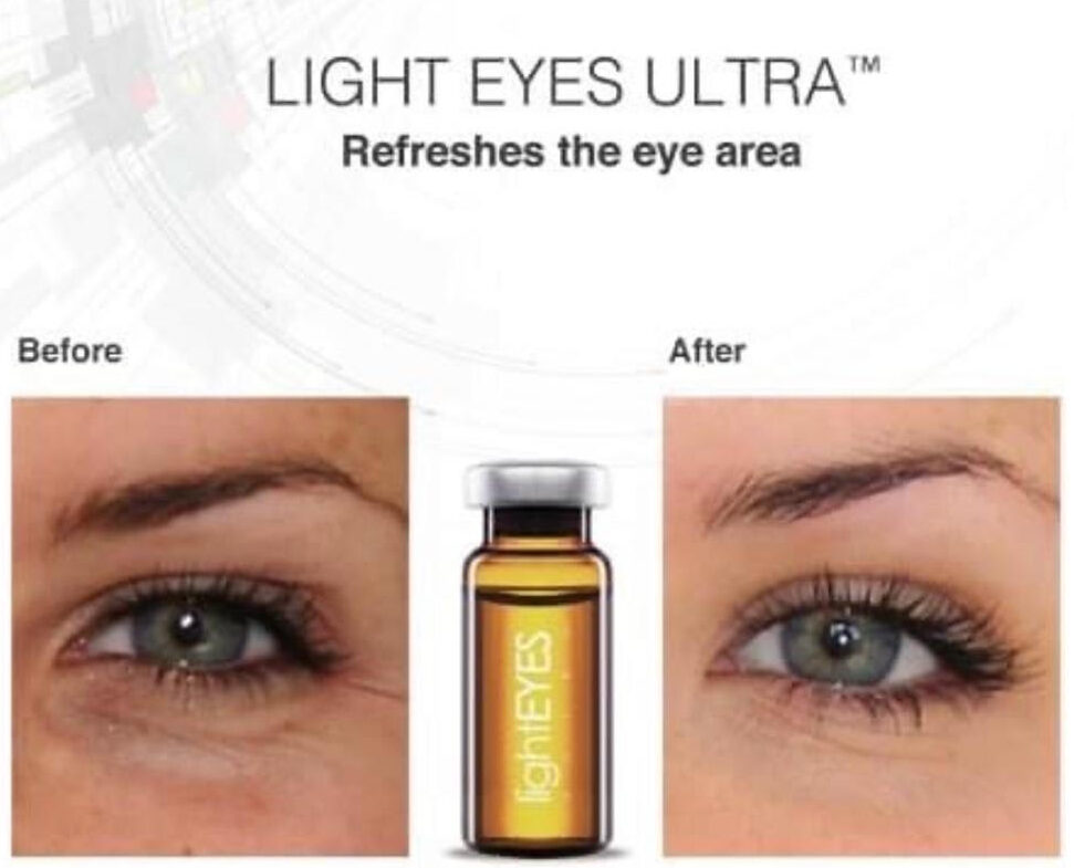 Light Eyes Ultra Before and After